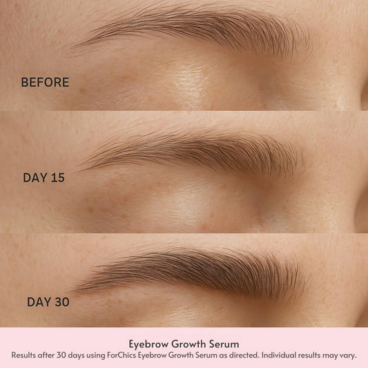 Eyebrow Growth Serum by - Natural Brow Thickening Treatment with Peptides and Biotin- Hormone-Free, Vegan and Cruelty-Free- Fuller Brows in 2 Weeks- 0.10Oz/3Ml